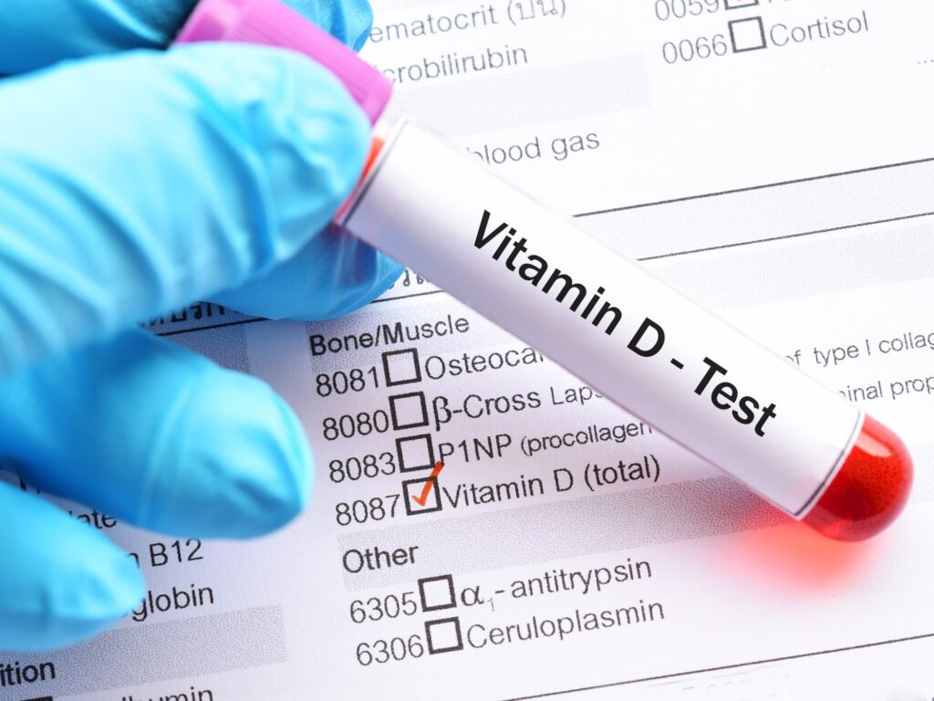 vitamin d vitamin d